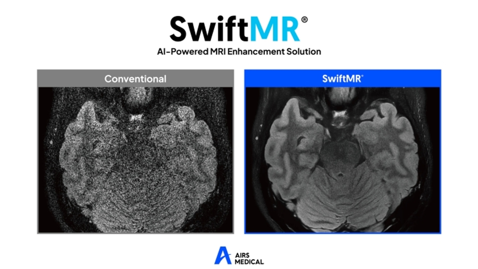 Source-provided image accompanying DealSite reports Airs Medical begins IPO preparations for AI MRI software