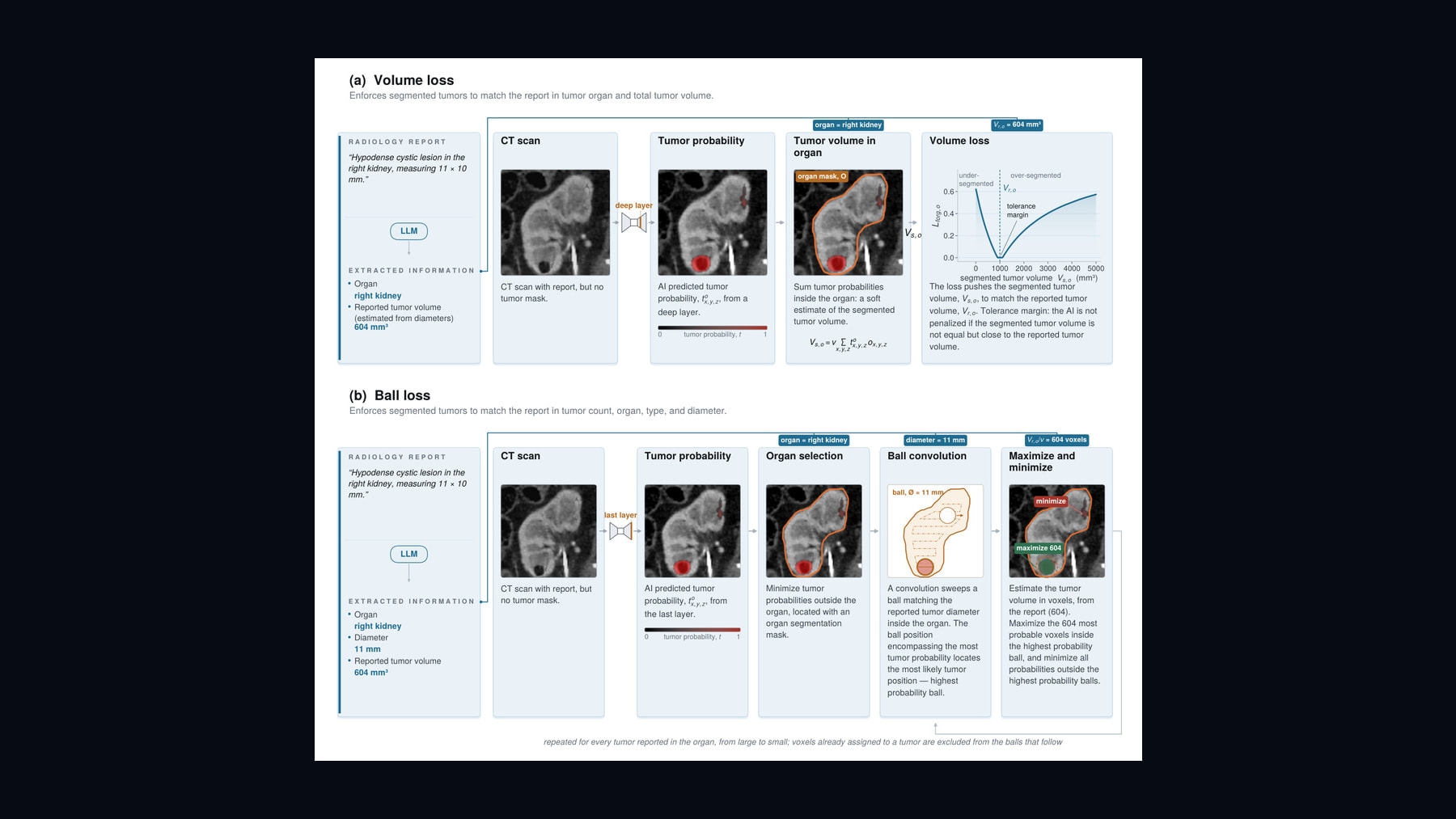 Source-provided image accompanying Report Supervision uses radiology reports to improve AI tumor segmentation